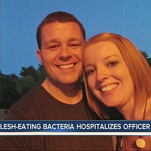 Flesh eating bacteria strikes Lee's Summit police officer - YouTube